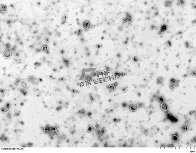 外泌体电镜染色步骤详解：从基础到应用