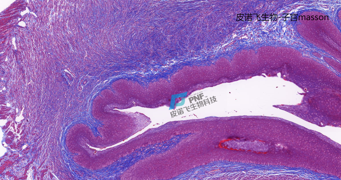 皮诺飞生物病理实验Masson染色实验方法