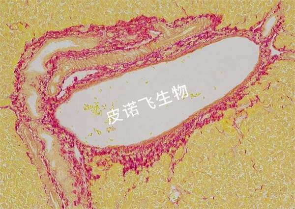 天狼猩红 肝