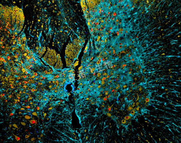 荧光三标 Spinal Cord GFP MF485_β-Tubulin MF555_Neun MF675_DAPI