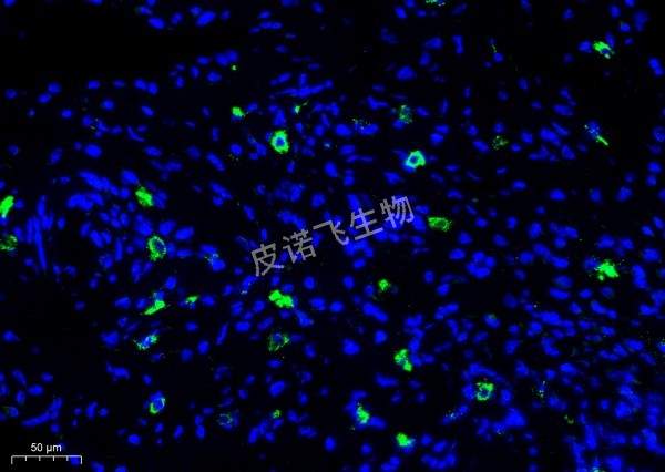 CD47绿_肿瘤
