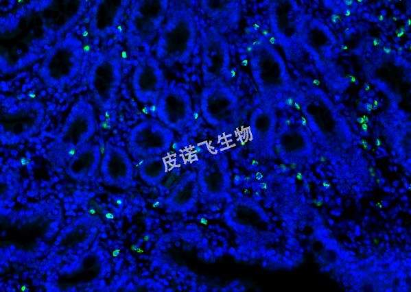 CD68探针绿 肠_40.0x