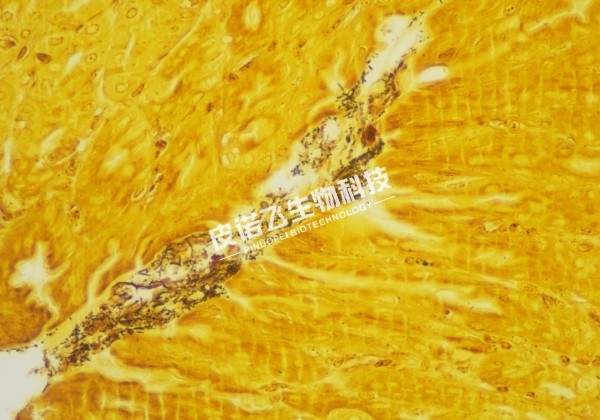 Warthin-starry银染胃