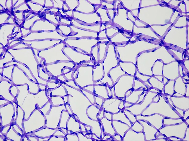 大鼠视网膜血管网PAS染色