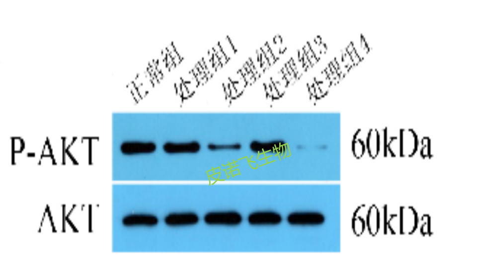 WB检测公司：为您提供专业的生物技术检测服务