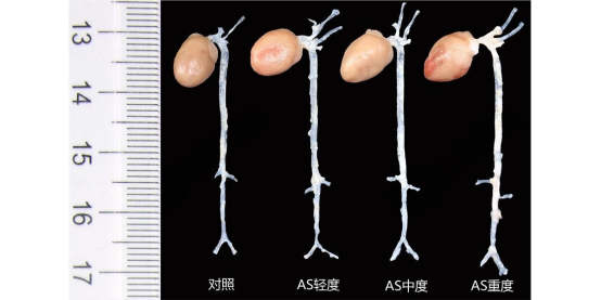 小鼠动脉粥样硬化(As)模型